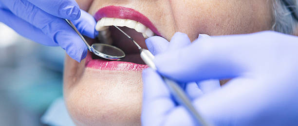 Best Emergency Dentist for Lost Fillings or Crowns in Silverton, OR